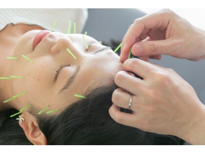 ハリシー鍼灸院の写真