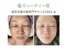 ルキア(LUKIA)/24年はランク4位！