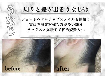 アルゴ 久留米店(ALGO)/【うなじ】WAX人気パーツ第2位!