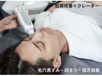 BUB 立川の写真/ニキビケアにもお勧め《サーマトリックス》毛穴もキュッとハリ肌へ!清潔感が"顔に出る"肌メンテはお任せ◎