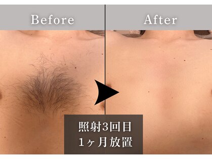 エルモリア(ELMOREA)の写真