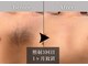 エルモリア(ELMOREA)の写真
