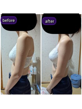 スノードロップ(snowdrop)/