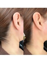 ナル(NaLu)/うなじワックス