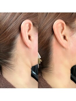 ナル(NaLu)/うなじワックス