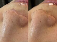 テオリア(TEORIA)/