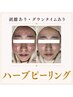 ※リアクションありハーブピーリング(つるんとたまご肌)毛穴、ニキビに!
