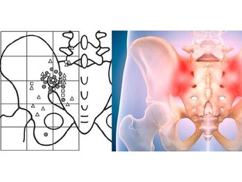 ワンアップカイロプラクティック(1up)/仙腸関節の痛み