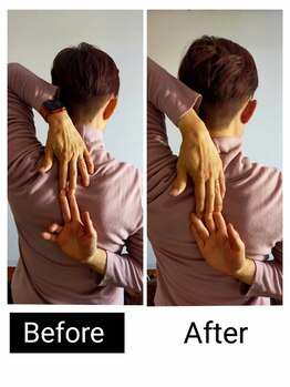 アース エンジェル整体院/ビフォアフ 肩甲骨はがし