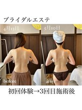 イム(I'm.)/ブライダル before/after