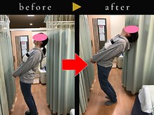 杉本接骨鍼灸院/若々しい背骨を取り戻す整体