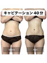 アネモネ/ダイエット/痩身/耳つぼ/腸活