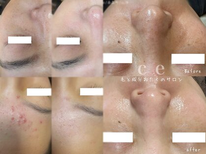 シャルム エスボーテ(charme Esbeaute)の写真