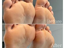 カシェット 広島店(Cachette)/40代女性☆足裏角質ケア90分