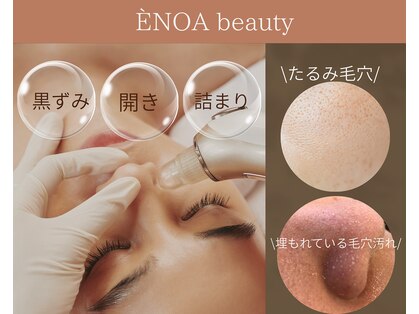 エノアビューティー(ENOA beauty)の写真