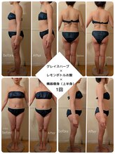 ビューティーサロン ラ ルーチェ(beauty salon La Luce)/レモンボトル×機器痩身×ハーブ