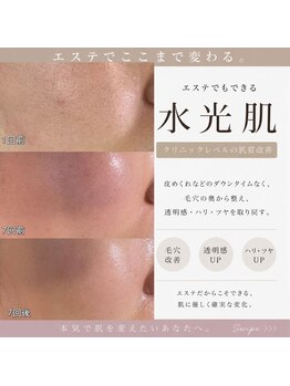 毛穴研究所の写真/【3か月集中!!本気の毛穴、美肌ケア】美容経歴25年/施術実績多数◆毛穴のプロによる独自の角栓除去法
