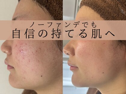 アエオボンヌール(A.E.O BONHEUR)の写真