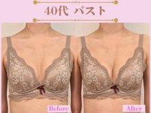 アファン 鶴見店(Afun)の雰囲気(40代からの下垂・しぼみ・左右差に寄り添うバストケア)