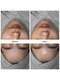 サラン スキンサロン(Sarang skin salon)の写真/【お肌に優しい美肌ワックス】マツヤニ不使用&鎮静パック付き◎頑固な毛穴汚れや不要な角質を徹底オフ！