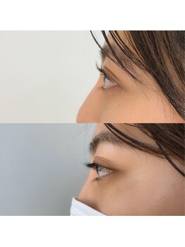 ビースタイル(B-style)/【マツパ】ラッシュリフト