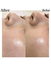 プリュスマイル(+Smile.)/フェイシャルワックス