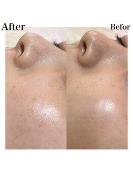 プリュスマイル(+Smile.)/フェイシャルワックス