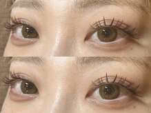 チッパー(CHIPPEr)/バインドロック