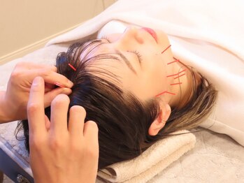 トトノエ(TOTONOE)の写真/【美容鍼×小顔調整】小顔・頭蓋骨ソムリエによる小顔特化型プライベートサロン★ターンオーバーで代謝UP！