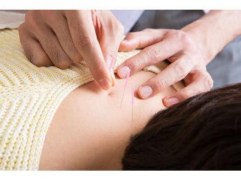 さくら鍼灸整骨院/プロによるダイエットのサポート