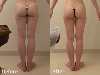 ラヴィエ ベル(La vie est belle)/下半身