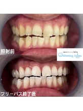 ホワイトニングサロン 熊本店/ホワイトニングサロン熊本