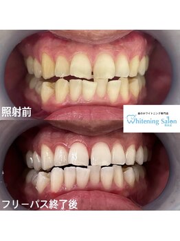 ホワイトニングサロン 熊本店/ホワイトニングサロン熊本
