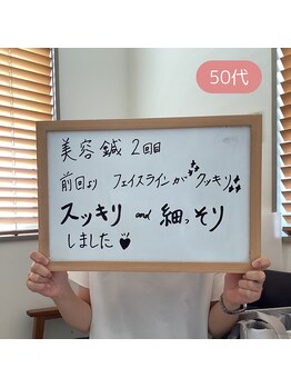 和らぎの森/★美容鍼(50代)