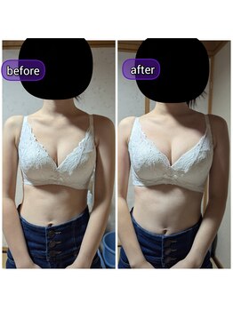 スノードロップ(snowdrop)/