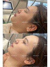 ナラビューティー(NARA BEAUTY)/韓国最新オンタリフト導入！