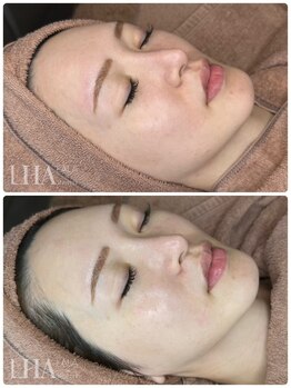 ピュアソル 福岡店(Puresol)/ララピール