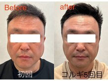 ビーキュート 学芸大学店(BE-CUTE)/Before/After　施術