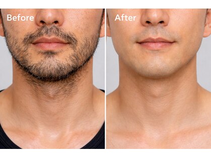 ジェントルスキン 銀座駅前店(GENTLE SKIN)の写真