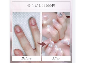 ハッピービューティー(Happy Beauty)の写真/パラジェル取扱店☆深爪/薄爪/弱爪でお悩みの方に◎フィルインを導入し、爪を傷めず美爪に育てます。
