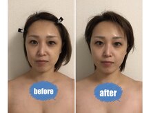 ココ(coco)/効果抜群たるみケア☆