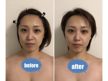 ココ(coco)/効果抜群たるみケア☆