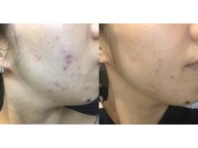 サロン リーナ 北千住店(Salon Lena)/こだわりの自社製品VinatuleVC30