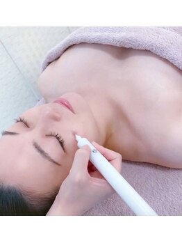 シュバル(CHEVAL)/お悩みのシミ・・お任せください