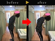 杉本接骨鍼灸院/若々しい背骨を取り戻す整体