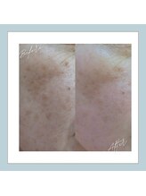 ラシュレ(BEAUTY CONCIERGE RASSURER)/シミ、しわ、たるみにもND-R！