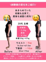 あおぞら鍼灸整骨院/ダイエットコース　お客様の声2