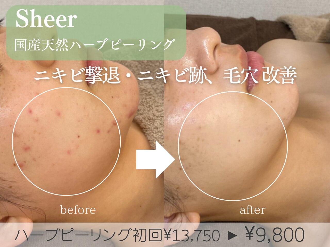 シアー(Sheer)｜ホットペッパービューティー