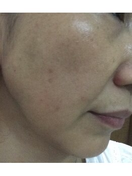 デンドロビューム(Dendrobium)/お客様の例1