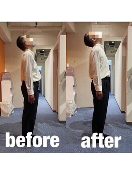 カワル整体 上通り院/もみほぐしで良くならない理由